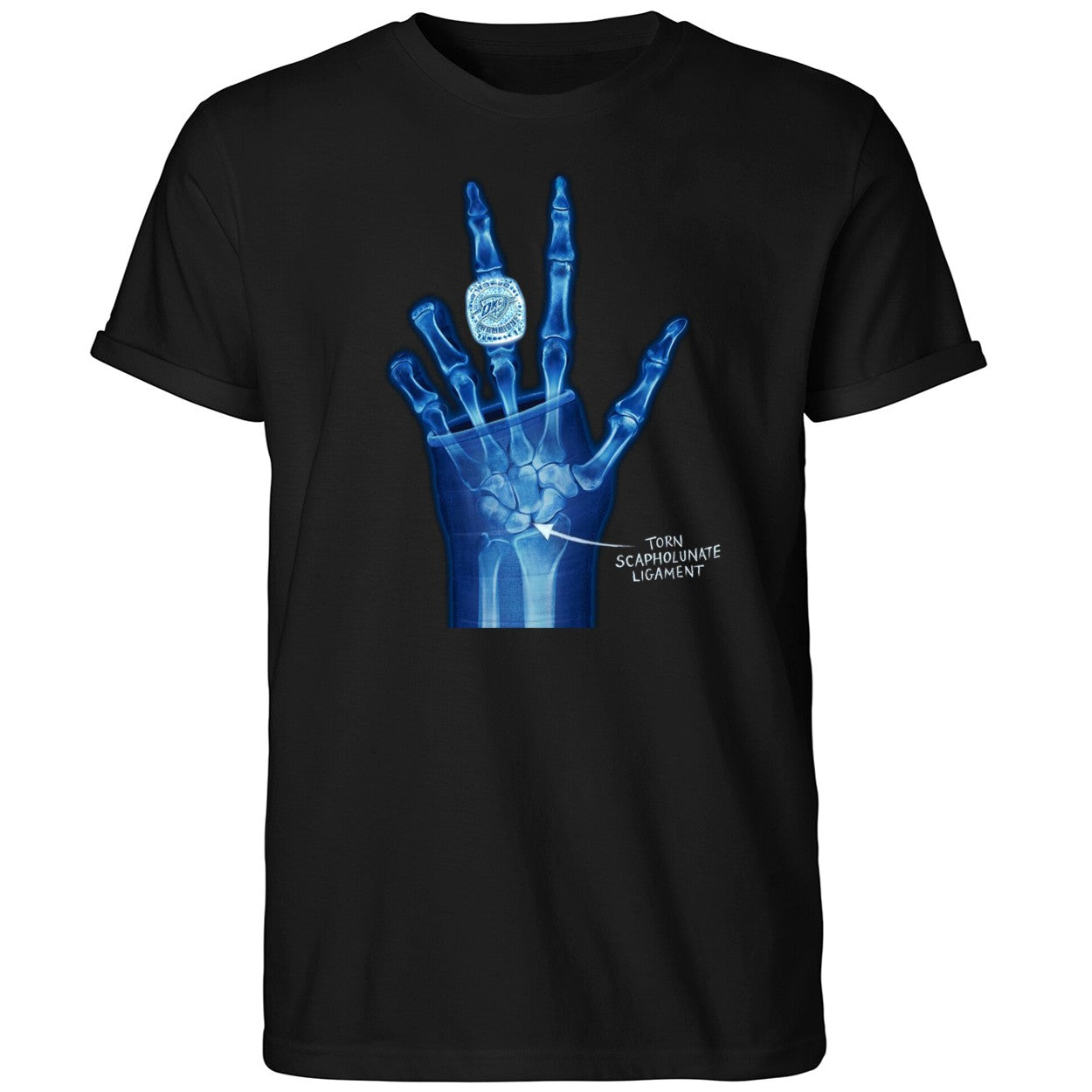 OKC Ring Torn Scapholunate Ligament Shirt