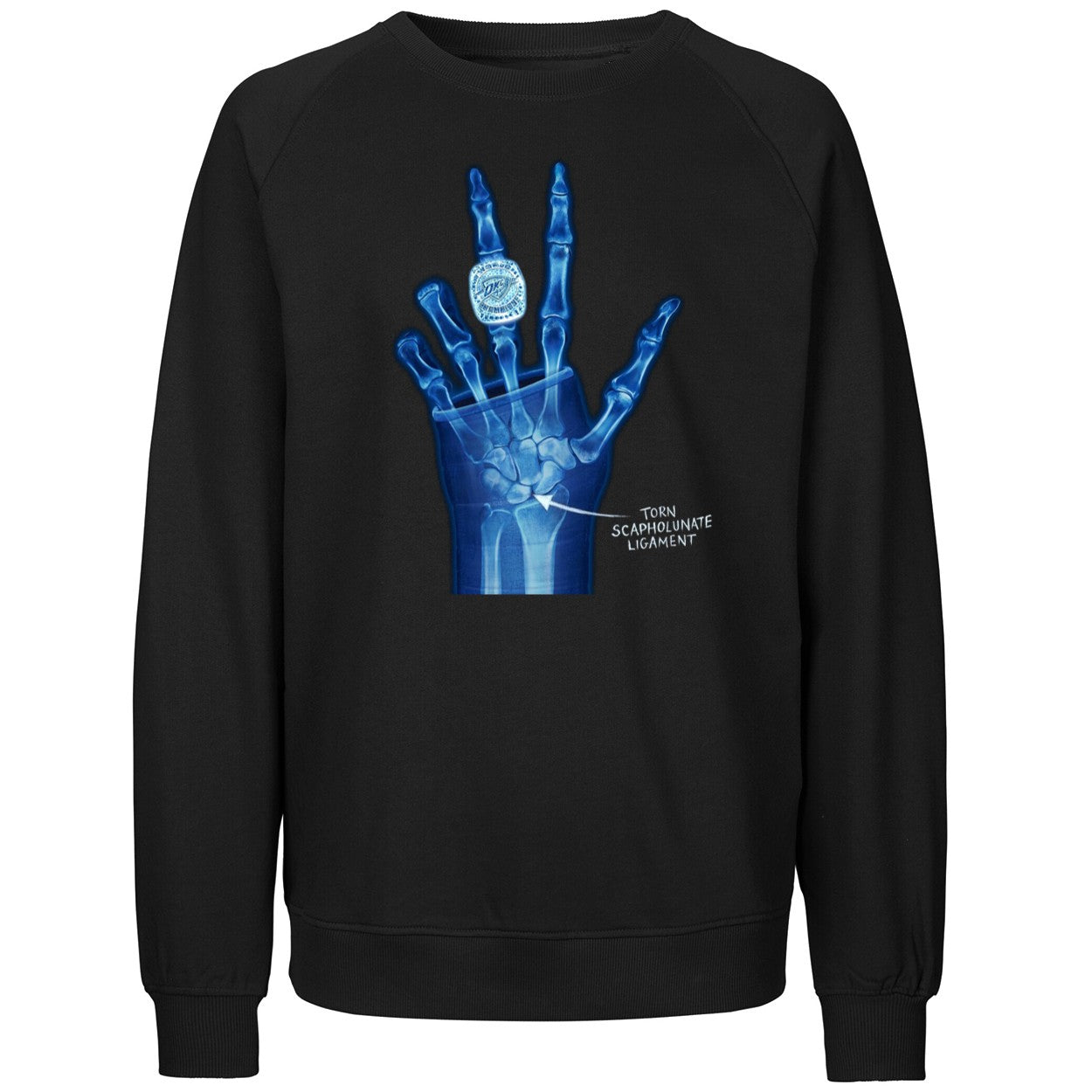 OKC Ring Torn Scapholunate Ligament Shirt