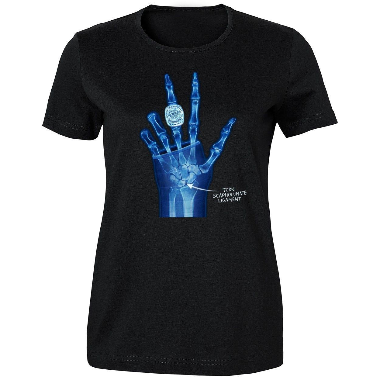 OKC Ring Torn Scapholunate Ligament Shirt