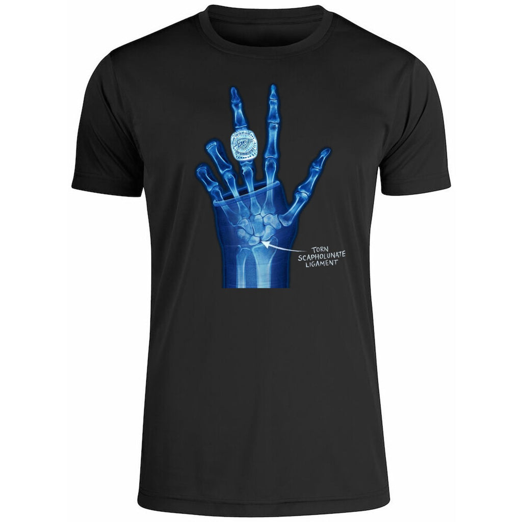 OKC Ring Torn Scapholunate Ligament Shirt
