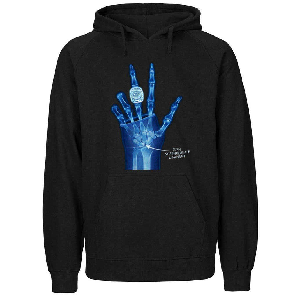 OKC Ring Torn Scapholunate Ligament Shirt