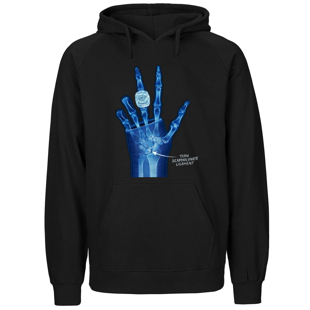 OKC Ring Torn Scapholunate Ligament Shirt