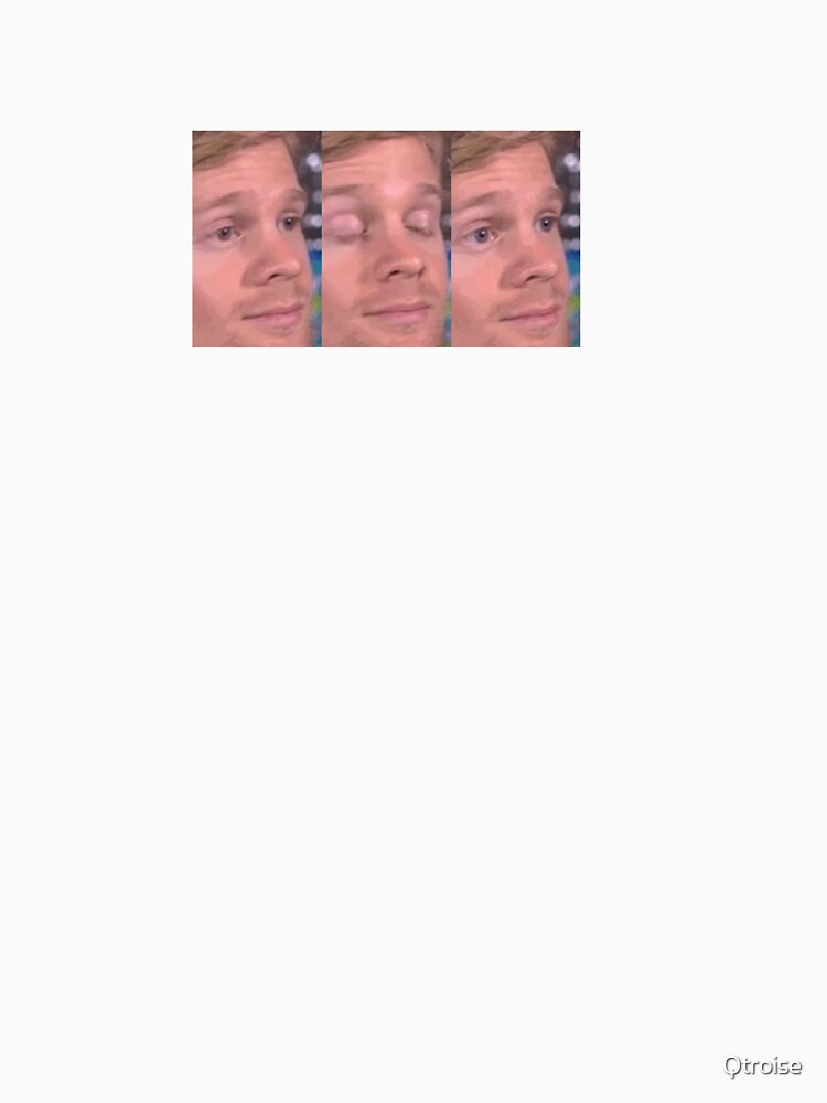 Viral Blinking White Guy / White Guy Blinking Iconic Meme Drew Scanlon by Qtroise