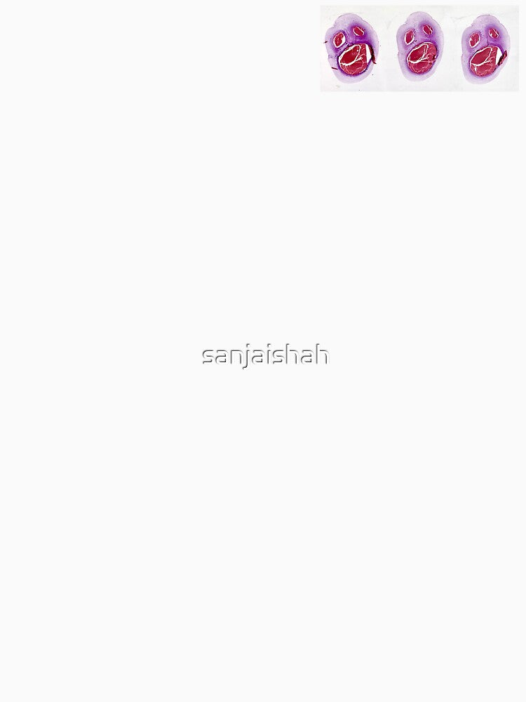 Umbilical Scream by sanjaishah