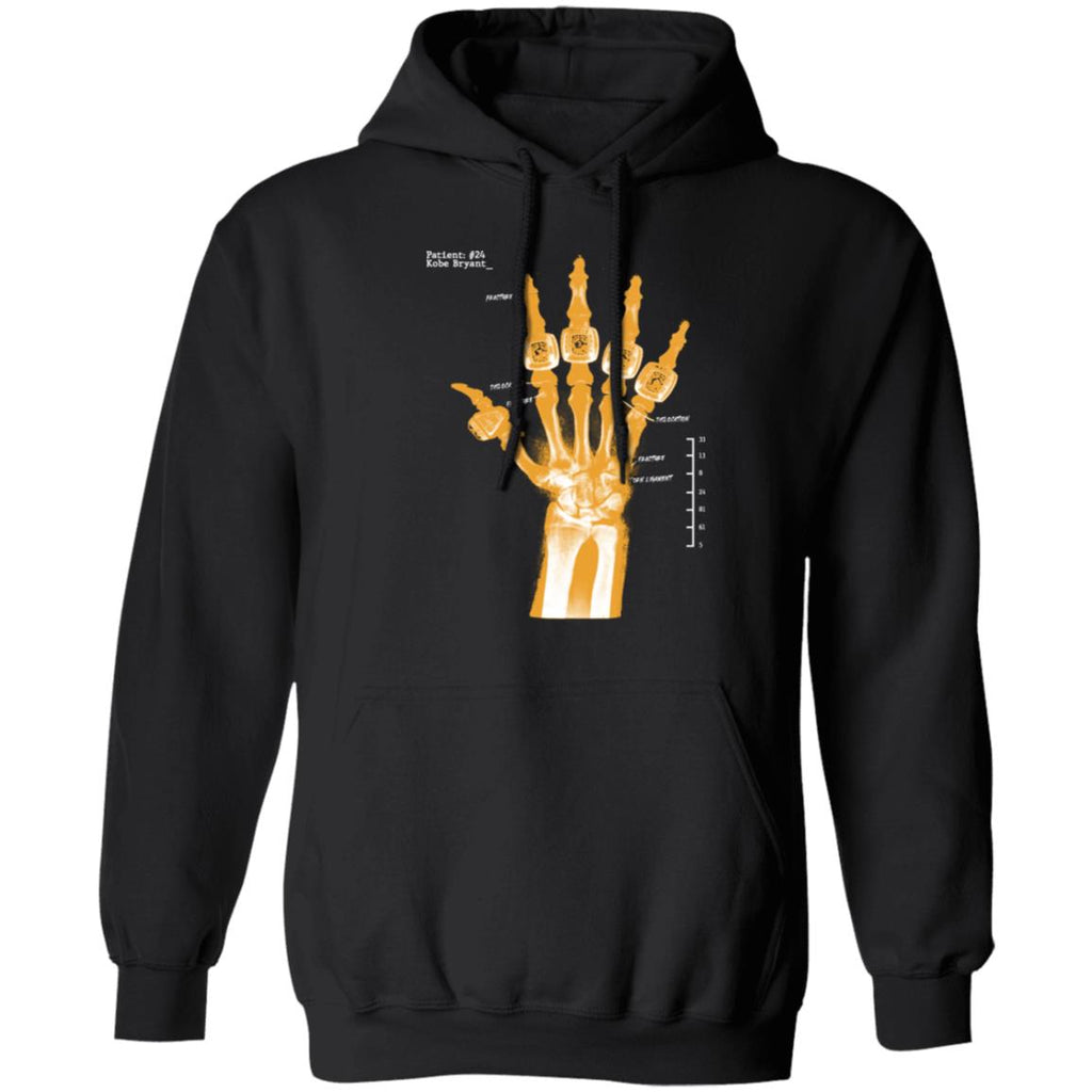 Kobe Bryant Hand Xray Shirt, Hoodie, Tank